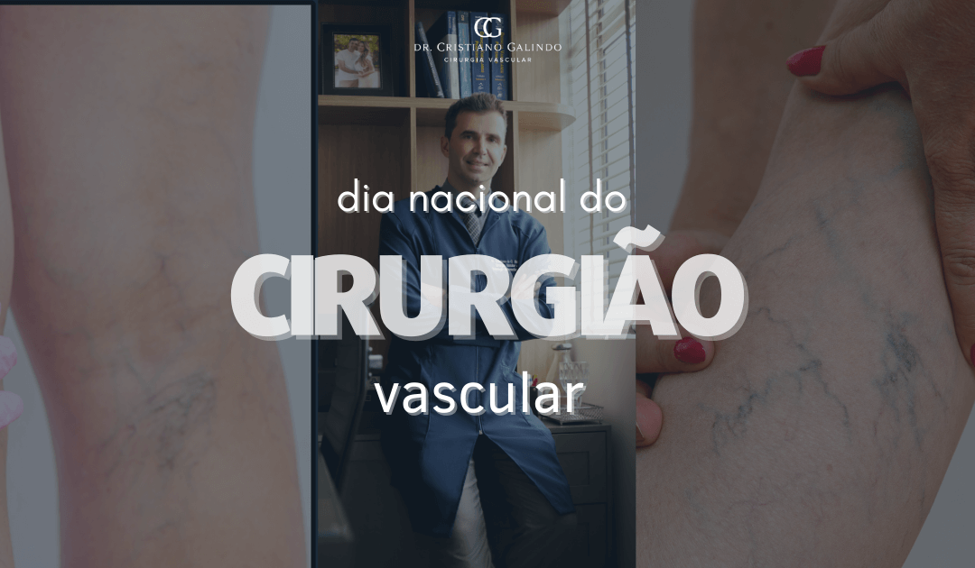 Imagem com varizes e uma foto do Dr. Cristiano, escrito por cima dia nacional do cirurgião vascular