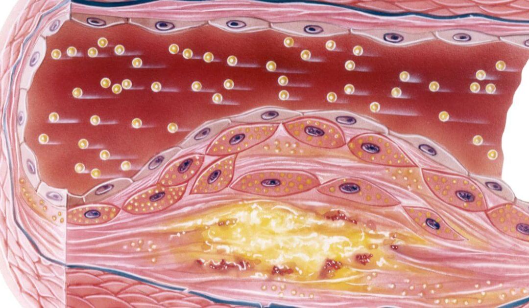 como o estresse vascular pode afetar sua saude vascular