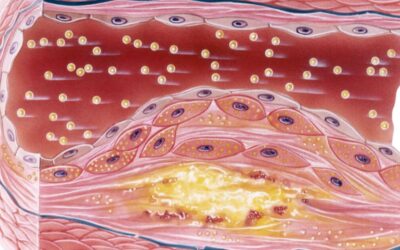 Como o estresse vascular pode afetar sua saúde vascular