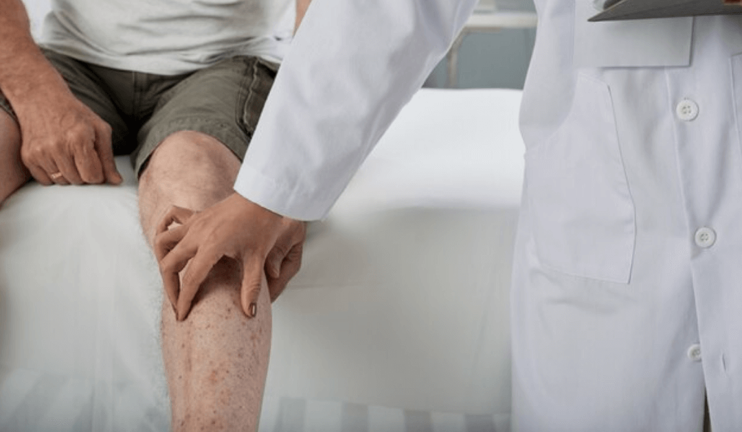 Existe a necessidade de forte sedação na cirurgia de varizes com endolaser feita em consultório?