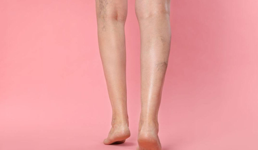 O que seu corpo esta tentando dizer quando você sente peso nas pernas ao acordar