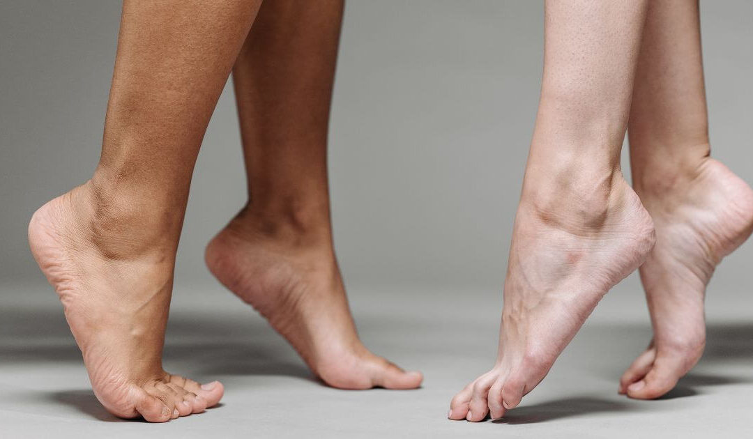 3 sinais na pele que indicam que as varizes não são um problema somente estético