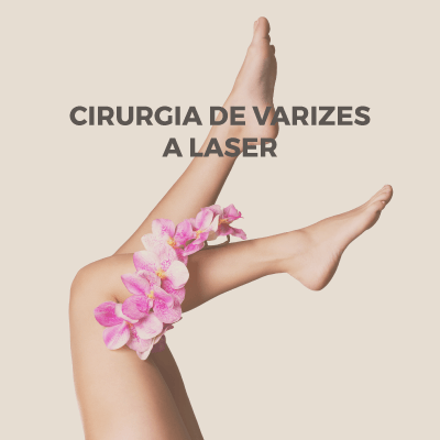 cirurgia-de-varizes-a-laser